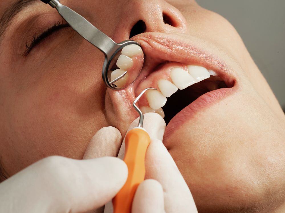 Hvorfor det er viktig å gå til tannlegen?